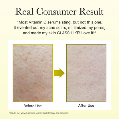 Arencia™ Vitamin C Booster Shot